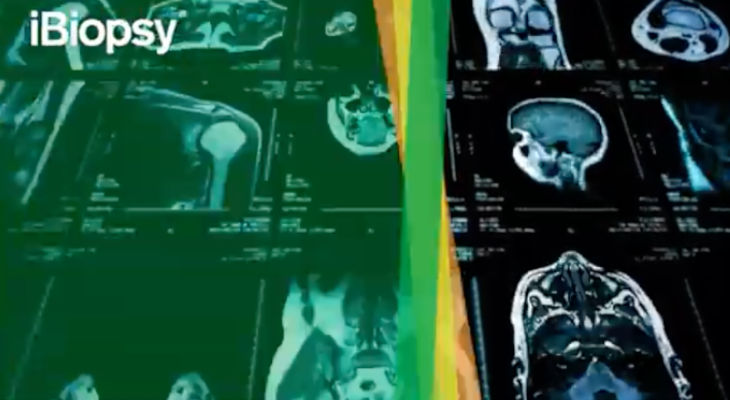 Intelligence artificielle : Median Technologies crée Imaging Lab, pour intégrer l’IA dans les services iCRO d’imagerie pour les essais en oncologie
