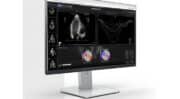 Pie Medical Imaging présente sa dernière technologie logicielle d’échocardiographie, CAAS Qardia 2.0