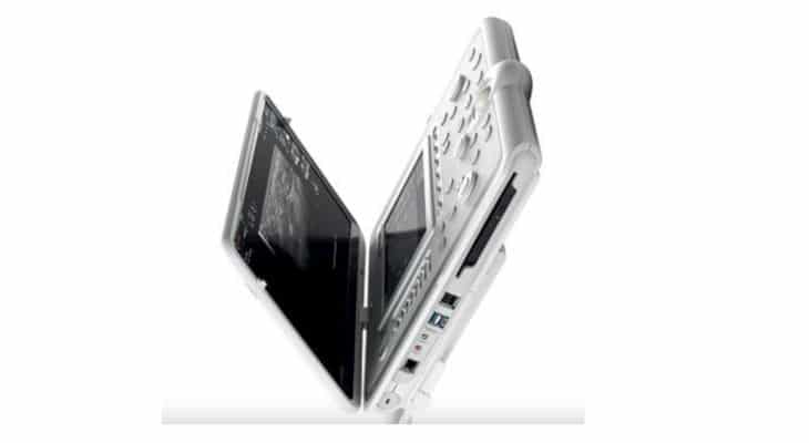 Esaote dévoile MyLab Omega eXP, un nouveau système d’échographie portable