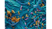 Le microbiote, de nouvelles perspectives pour la santé