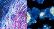 Formulations : L’Oréal et l’Institut Pasteur s’allient pour accélérer la recherche sur le microbiome cutané